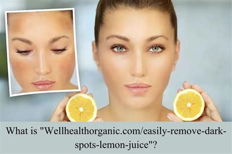 wellhealthorganic.com/easily-remove-dark-spots-lemon-juice|Wellhealthorganic.com: Easily Remove Dark Spots Lemon Juice